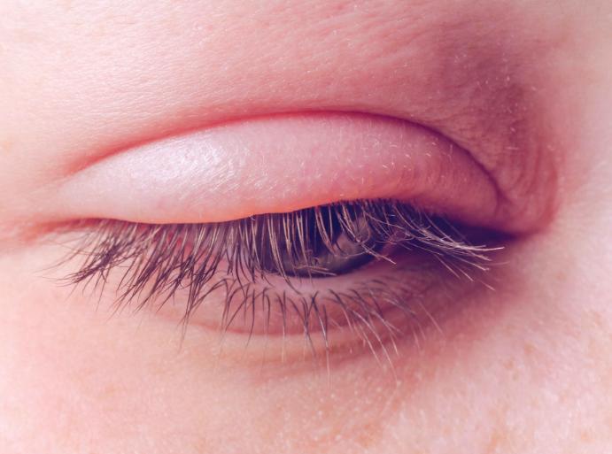 经常按摩眼部可以去除黑眼圈吗,按摩祛眼部皱纹最好的方法