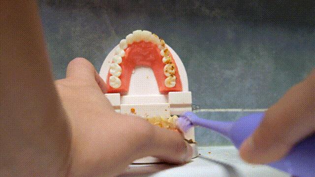 种植牙推荐电动牙刷,根据自己的牙选择电动牙刷