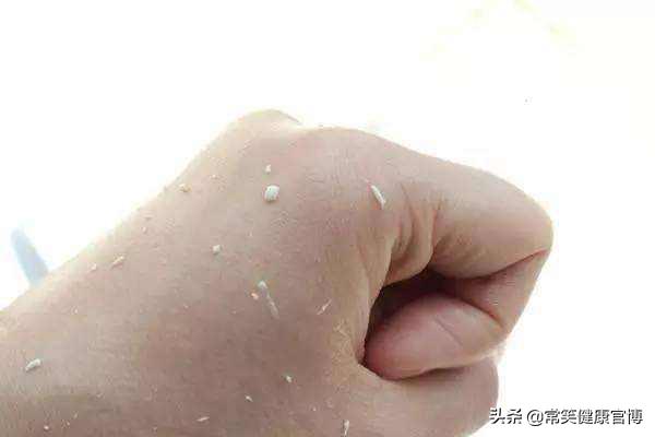 使用搓澡巾的害处,搓澡巾用了有害处吗