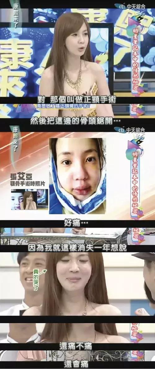 蔡徐坤身高成长史,蔡徐坤为什么相貌改变这么大