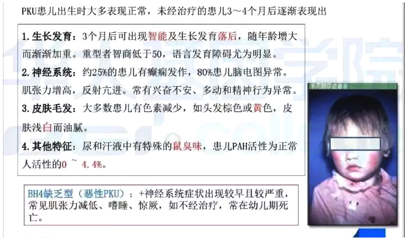 特医婴幼儿食品,苯丙酮尿症特医食品