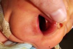 鐗欓緢涓婂皬鑲跨槫,鐗欓緢涓婄殑鑲跨槫