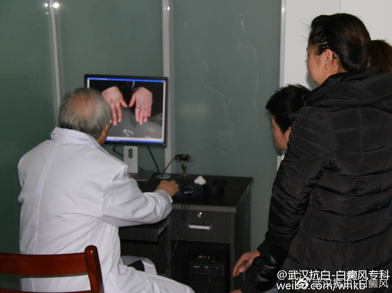 防治白癜风全面升级,武汉北大白癜风医院看白癜风