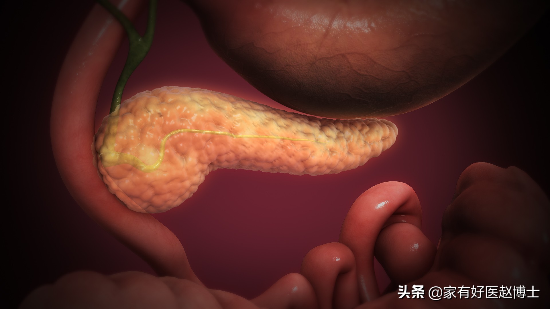 血糖高怀疑是糖尿病早期,怀疑血糖高一般有什么预兆