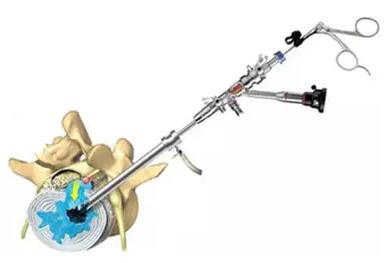 10分钟治疗椎间盘突出显奇效,椎间盘突出症保健图解