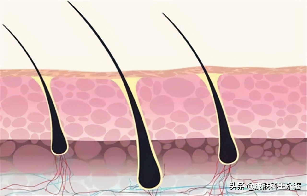 缺维生素白发,缺什么维生素可以长白发