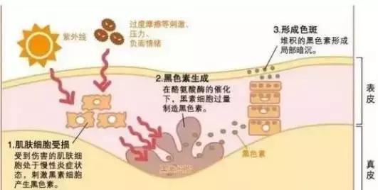 祛斑面诊必背知识点,要祛斑