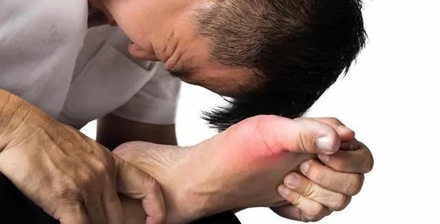 无症状高尿酸血症用不用治疗？