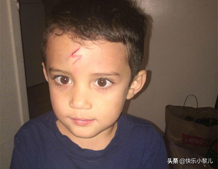 萌娃不小心撞到脑袋摔一跤,萌娃不小心撞到脑袋摔了一跤