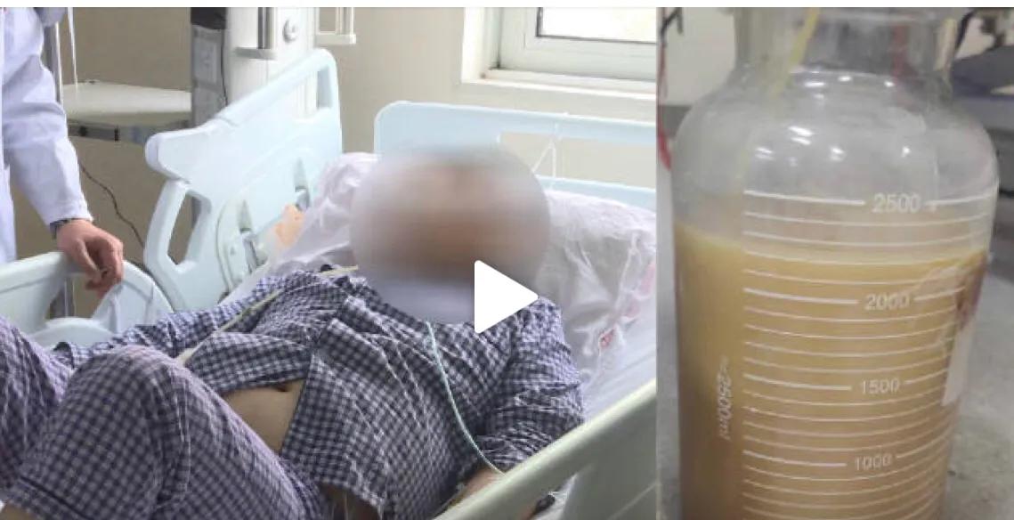 长期吃烧烤的后果新闻,长期吃烧烤喝酒会导致什么疾病