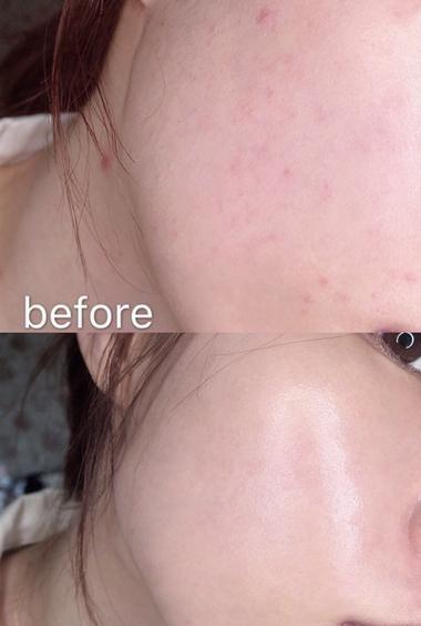 欧阳娜娜随手晒的面膜,一周卖出3万盒,网友:用完肌肤白里透红