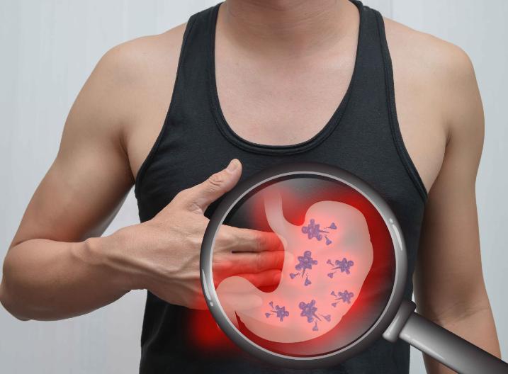 胃病严重会变成什么样,有胃病的人4个表现可能会癌变