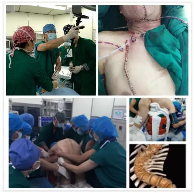 抢救病人团队合作,一群护士奔跑抢救病人