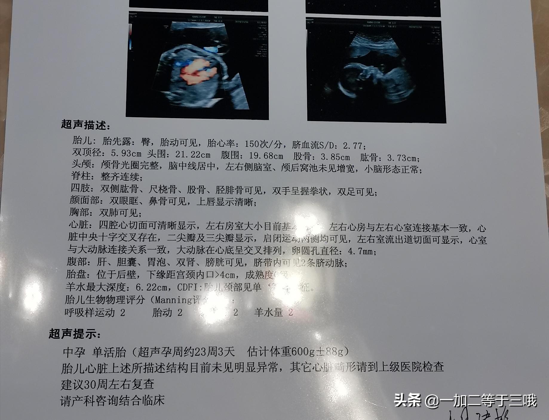 分享自身经历的孕期奇迹,回忆自己怀孕的艰辛