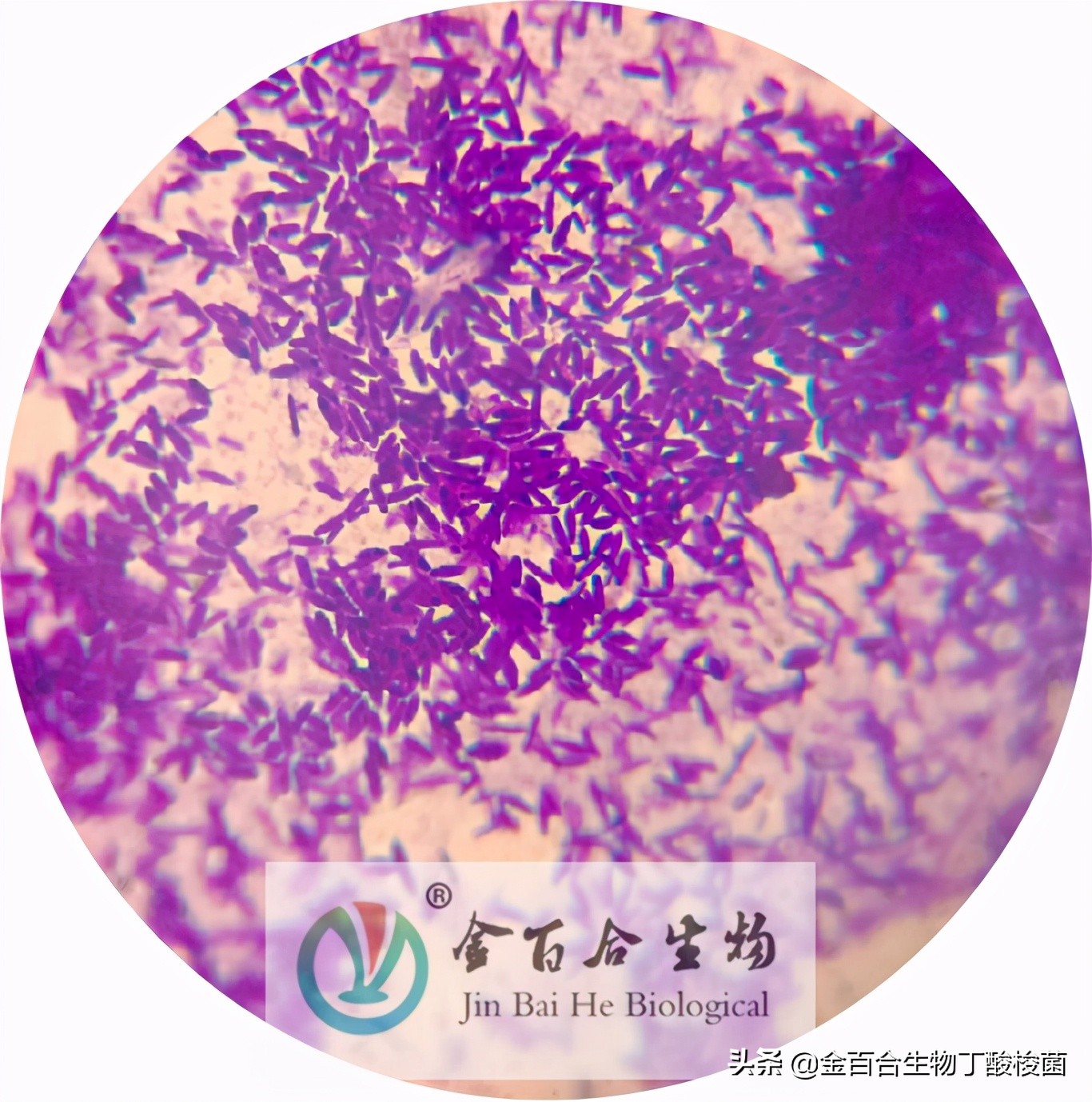 革兰氏染色显微镜下的图手绘,革兰染色用的显微镜是什么