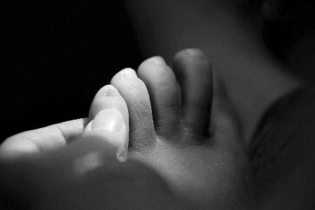 中国人小脚指甲分瓣什么原因,小脚趾甲分两瓣是汉人的特征吗