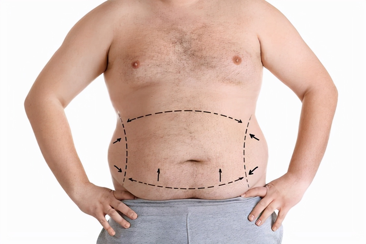 为什么我腹部腰部容易堆积脂肪,脂肪都堆积在腰部两侧是什么原因