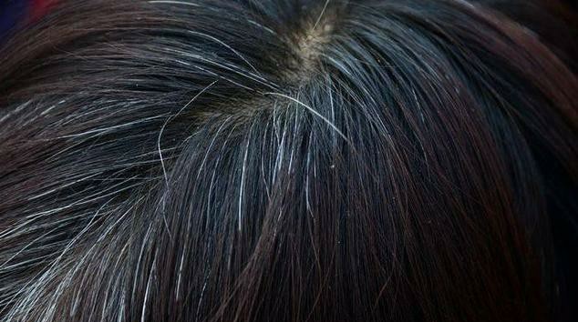 痘痘反复怎么除根护肤,痘痘反反复复怎么彻底祛除