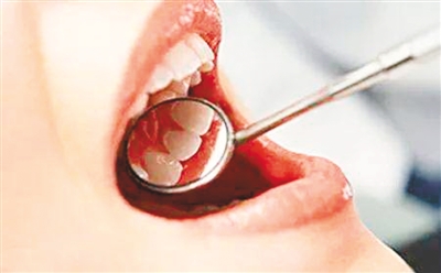 口腔溃疡预防与治疗用什么方法,关于口腔溃疡的日常用药