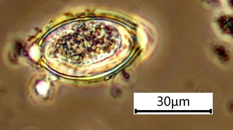 宠物寄生虫会传染人吗有什么症状,养宠物容易得寄生虫吗