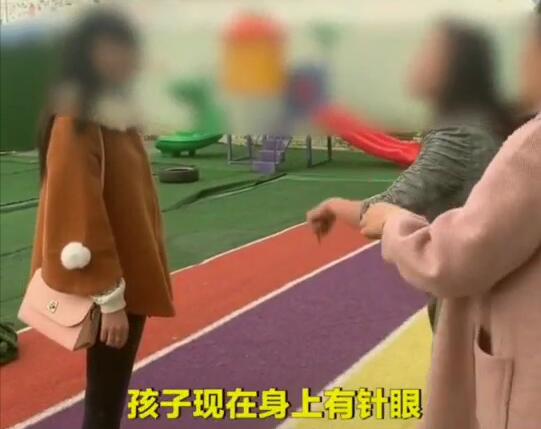 幼儿园孩子身上针眼可以做鉴定吗,幼儿园多名孩子身上有针眼追踪