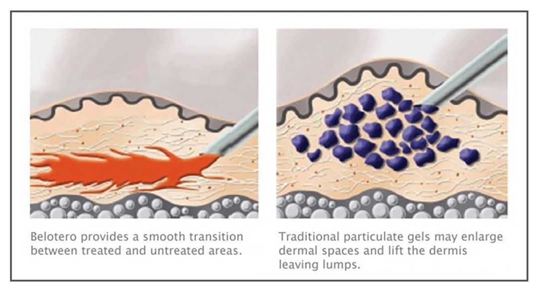 花了10800块去黑眼圈没效果,网上治疗黑眼圈靠谱么
