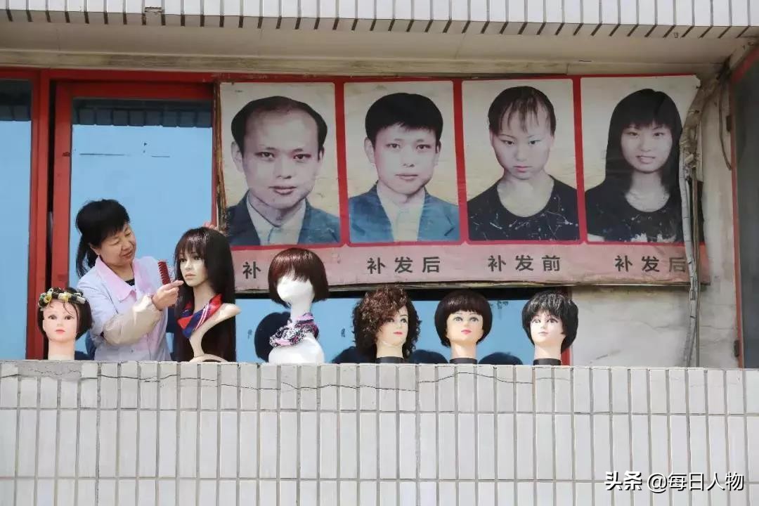 脱发知识普及,当代脱发现状