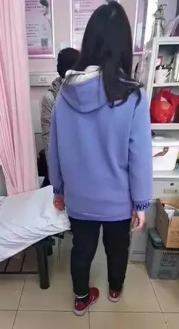 耻骨联合分离产后可以绑着睡觉吗,孕期耻骨联合分离缓解办法