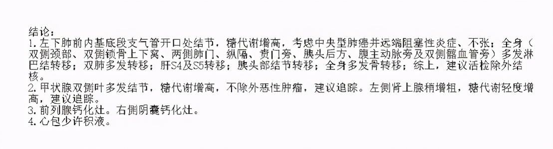 腰痛与肺癌有关吗,腰痛的厉害是得了肾癌吗