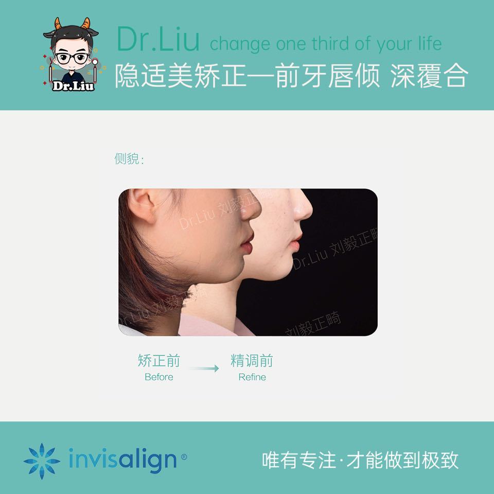 鍘﹂棬鐗欓娇缇庡,鍘﹂棬鐗欓娇鐭闅愬舰姝g暩