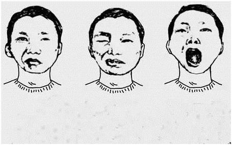 右眼皮一直跳真的会运气不好吗,眼皮跳是要发财吗