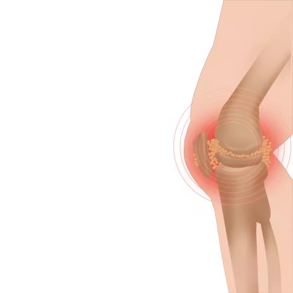 孩子韧带拉伤怎么做康复训练,孩子韧带拉伤怎么办