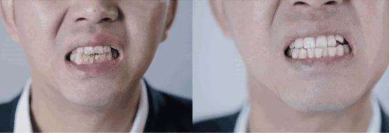 刷牙时一个小窍门彻底告别黄臭牙,刷牙的时候放点小苏打牙会变白吗