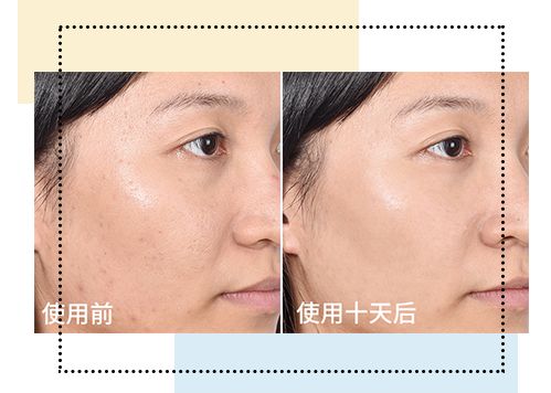 olay和欧莱雅哪个值得购买,欧莱雅和olay哪个性价比高