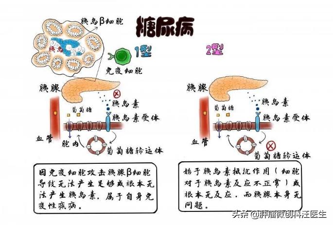 糖尿病人手术后伤口不愈合怎么办,糖尿病人术后伤口愈合最快的方法