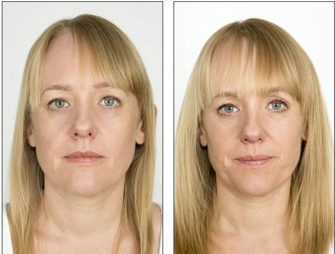 披头发怎么才能显脸小,短脸不适合披头发吗