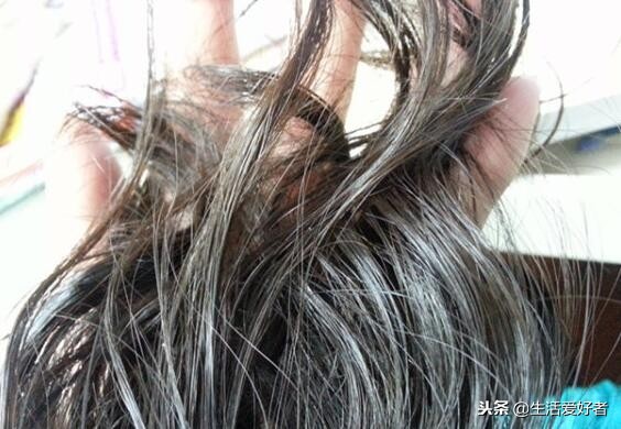 脱发怎么防脱发,秋冬季脱发如何预防