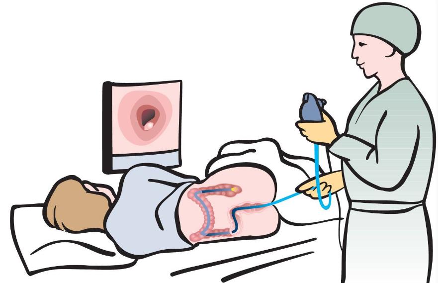 肠子有豹纹斑,肠子长豹纹