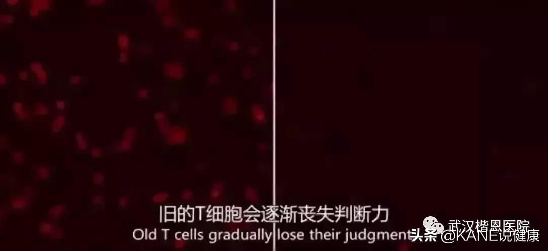 nk细胞消灭癌细胞实录,nk细胞杀神经元