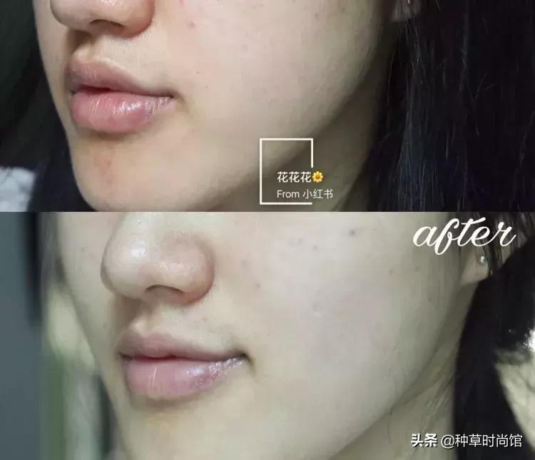 脸色暗黄干皮怎么变白最快方法,暗黄皮用什么护肤品变白