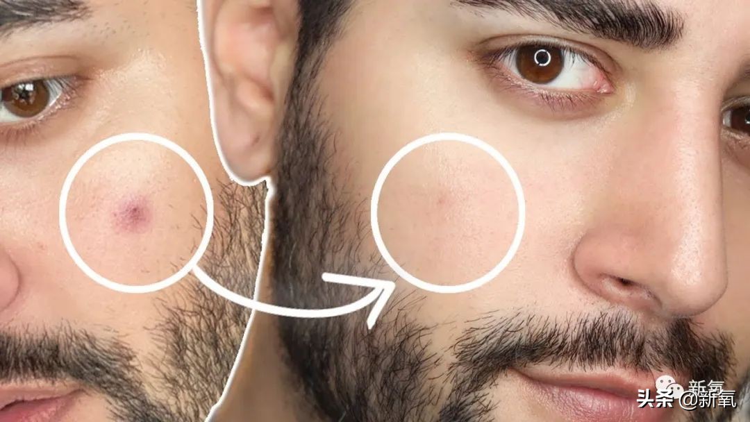 宋祖儿雀斑造型美到窒息,宋祖儿脸上的雀斑一清二楚