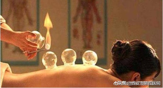 拔火罐的知识,拔火罐专业知识