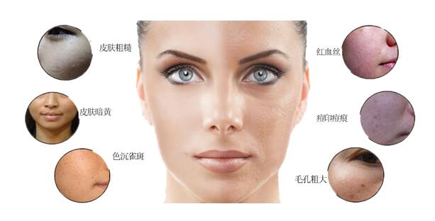 光子嫩肤的注意事项有哪些,光子嫩肤后需要注意的事项有哪些