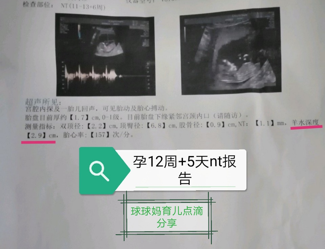 最简单的孕期报告单整理,孕期产检报告单怎么整理