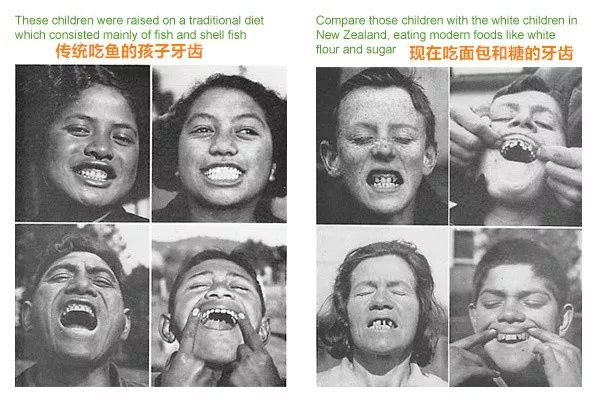 因纽特平均寿命多少,因纽特人寿命为什么这么短