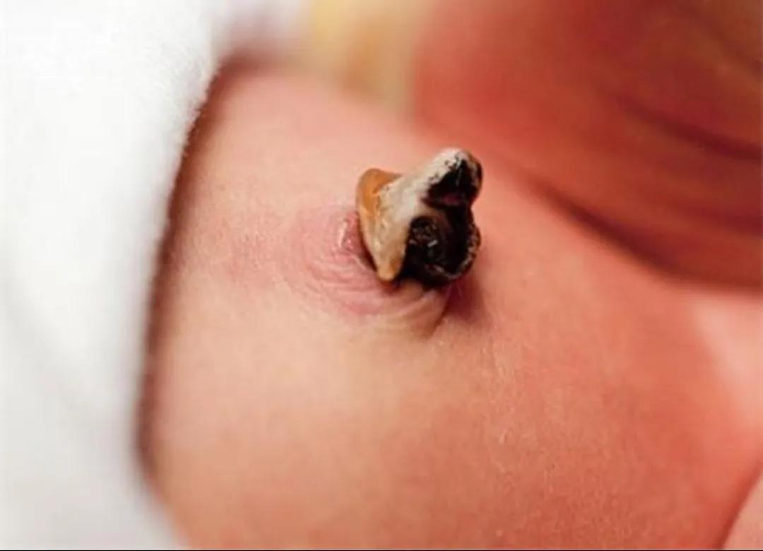 新生儿常见的皮肤问题,新生儿心脏血管常见问题