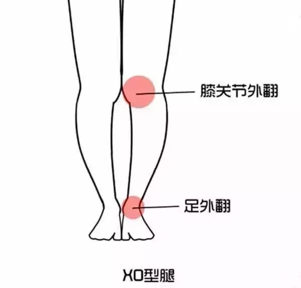20多岁让腿变直的方法,25岁之前怎么让腿长长