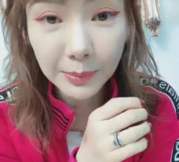 欧式大平行双眼皮什么意思,欧式双眼皮适合什么样的人割