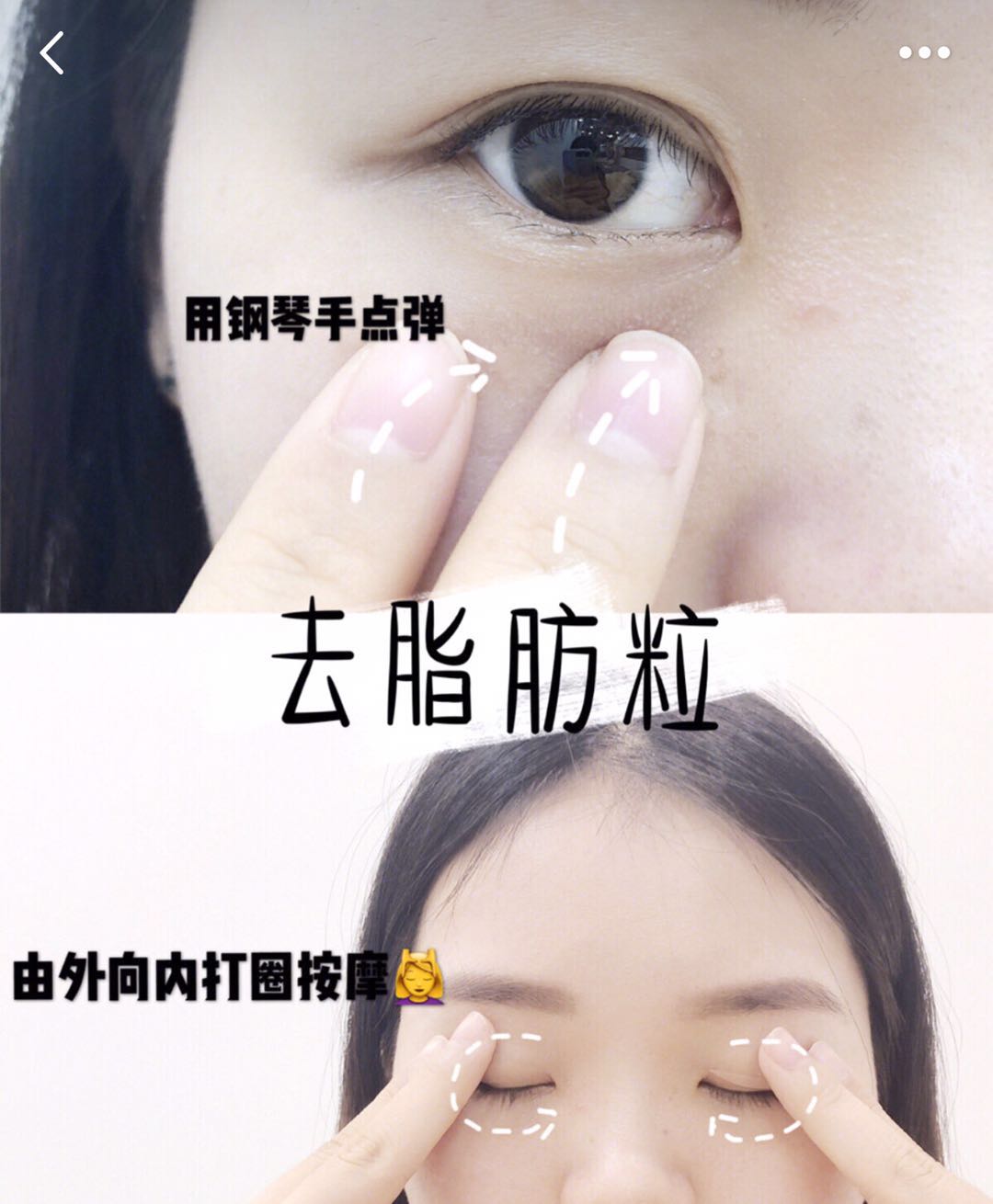 为啥有眼袋但涂眼霜会有脂肪粒,涂眼霜有脂肪粒怎么涂