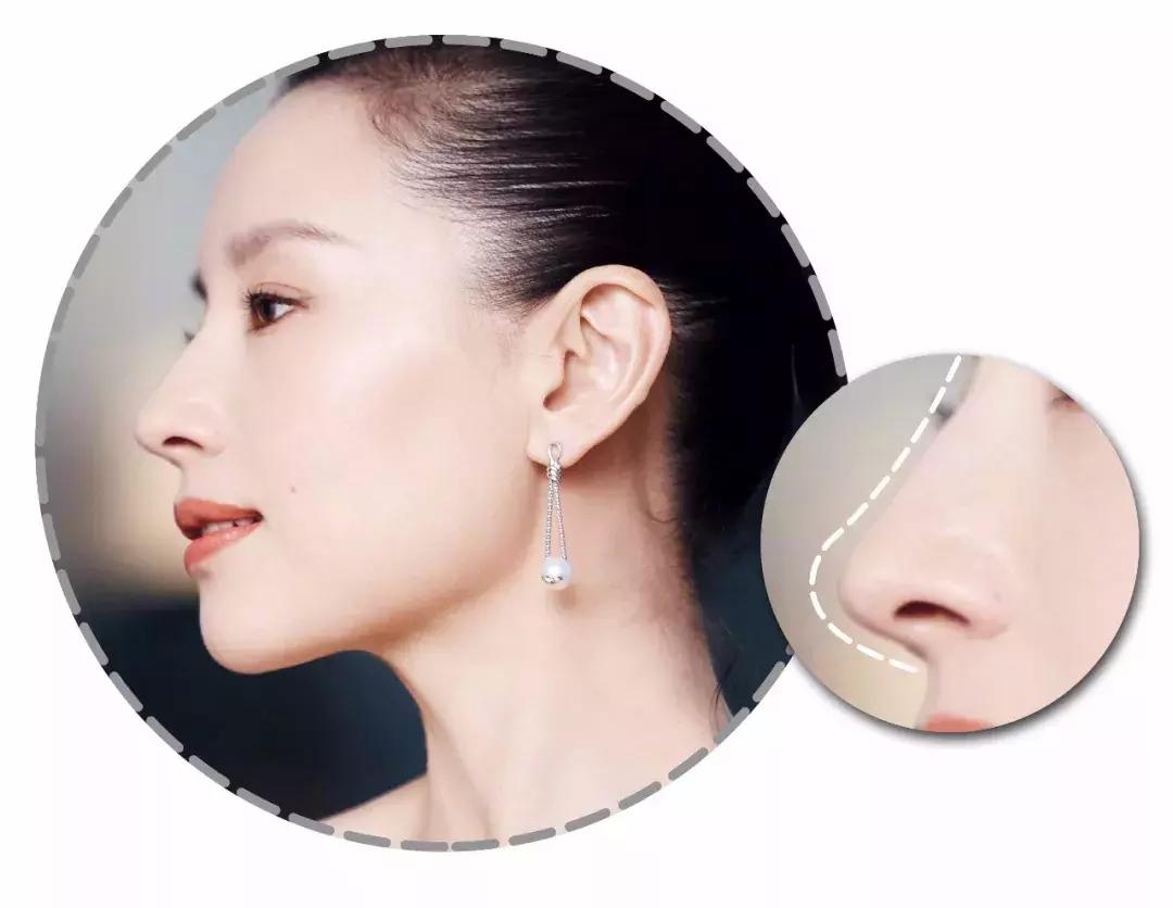 最好看的鼻子分哪几种,最好看的几种鼻子